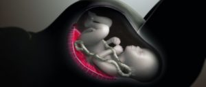 Microscópicas moléculas protegen a la placenta del ataque de parásitos