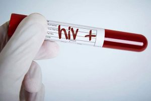 Científicos chilenos realizan importante hallazgo en la lucha contra el VIH: logran frenar multiplicación del virus a nivel celular