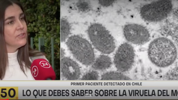 Entrevista a Dra. Lorena Tapia en 24 Horas AM de TVN, sobre primer caso de viruela del mono en Chile.