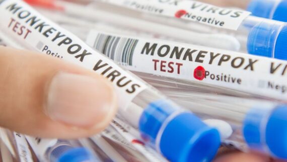 Viruela del mono ya tiene estatus de pandemia: ¿Cómo se contagia? ¿Hay vacuna?