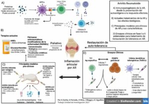 Exploran origen de artritis reumatoide: incapacita a 34 millones de personas en Latinoamérica