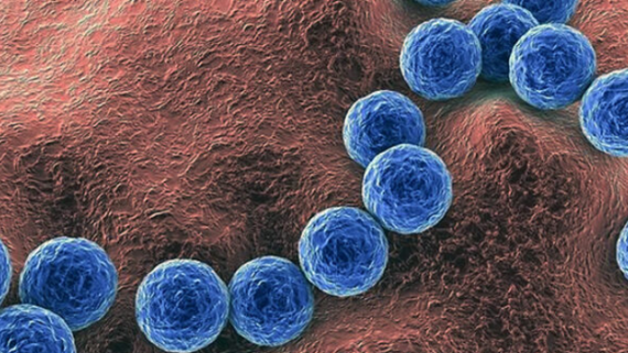 ¿Qué es la bacteria Streptococcus pyogenes?